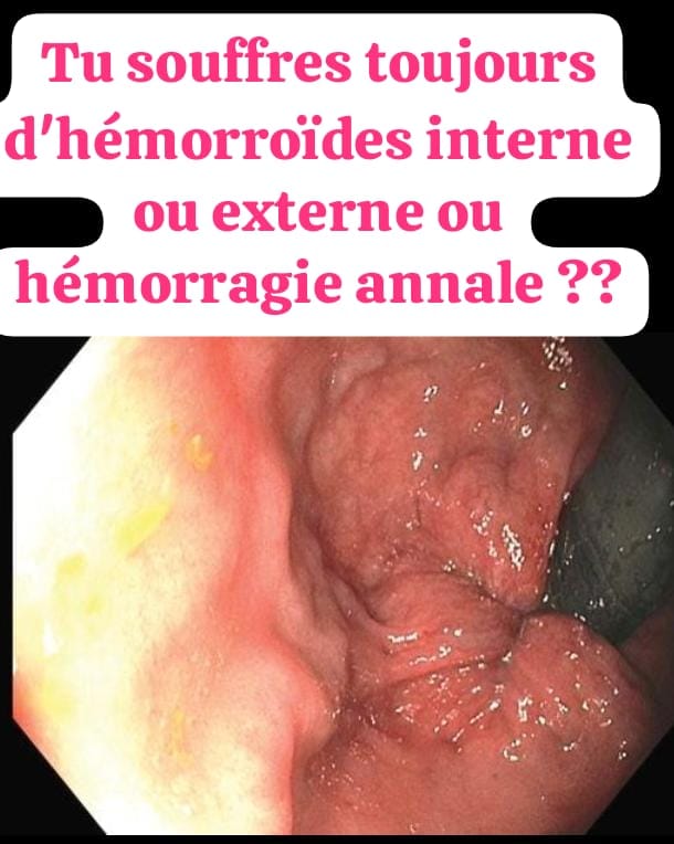 ⚡ PLUS DE FORCE, PLUS D'ENDURANCE, PLUS DE CONFIANCE : DÉCOUVREZ LE POUVOIR DU PETIT COLA ! 🌿🔥