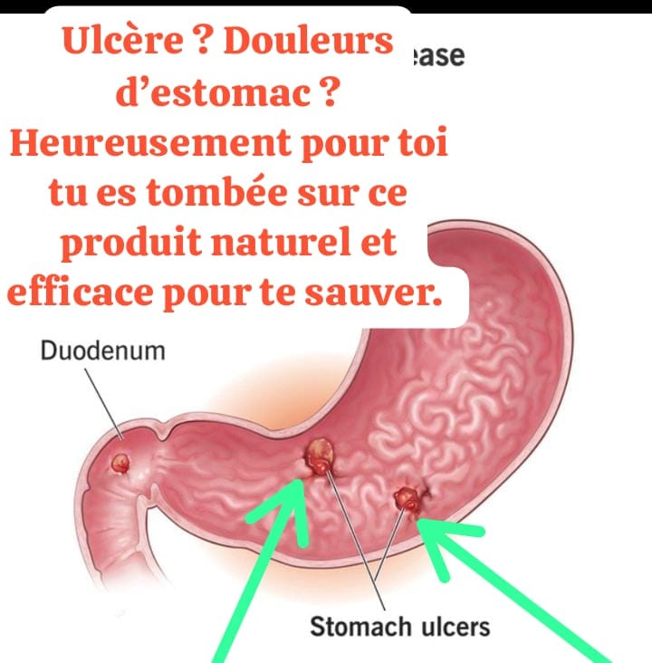⚡ PLUS DE FORCE, PLUS D'ENDURANCE, PLUS DE CONFIANCE : DÉCOUVREZ LE POUVOIR DU PETIT COLA ! 🌿🔥